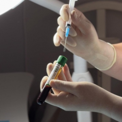 Плазмолифтинг суставов